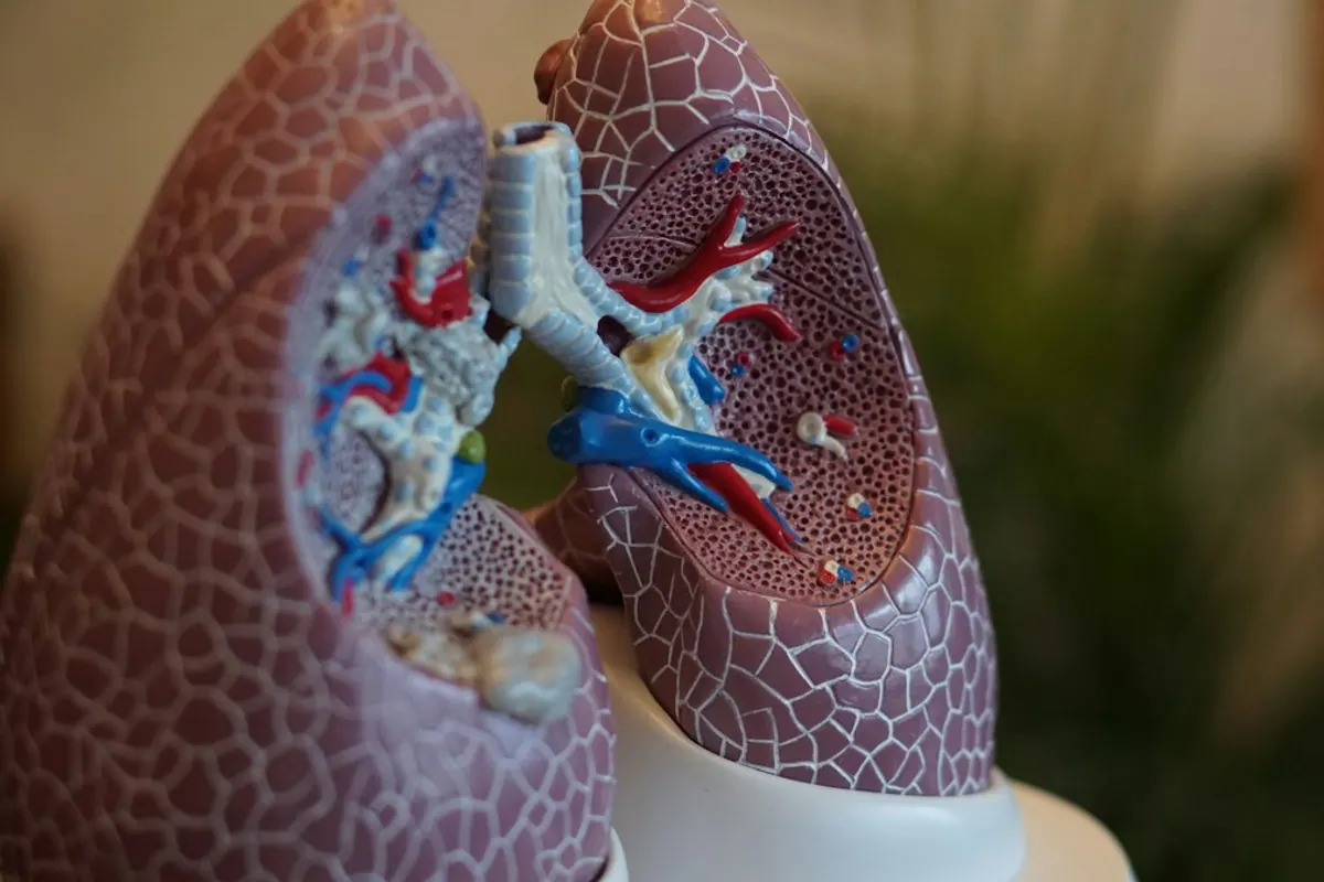 Anatomical lung model illustrating the health effects of smoking and the benefits of quitting